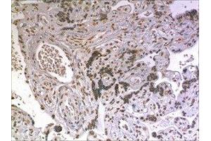 Immunohistochemistry (IHC) image for anti-Neurotrophic tyrosine Kinase, Receptor, Type 3 (NTRK3) (AA 32-428) antibody (ABIN1983471)