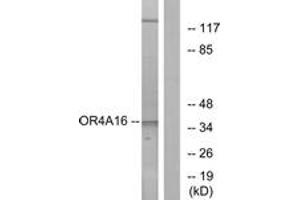Western blot analysis of extracts from COLO cells, using OR4A16 Antibody. (OR4A16 anticorps  (AA 261-310))