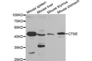 Western blot analysis of extracts of various cell lines, using CTSE antibody. (Cathepsin E anticorps)