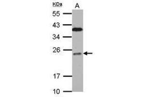 BCL7C antibody  (AA 1-215)