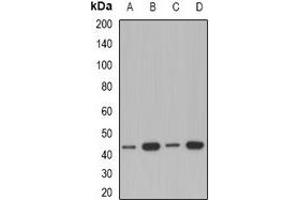 Western blot analysis of ACAA1 expression in A549 (A), Jurkat (B), mouse kidney (C), rat liver (D) whole cell lysates. (ACAA1 anticorps)