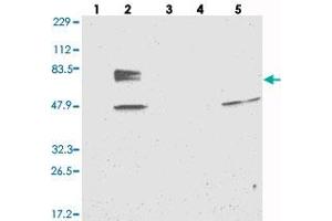 Western blot analysis of Lane 1: RT-4, Lane 2: U-251 MG, Lane 3: Human Plasma, Lane 4: Liver, Lane 5: Tonsil with EYA4 polyclonal antibody . (EYA4 anticorps)