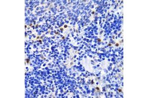 Immunohistochemistry of paraffin-embedded mouse spleen using ANXA1 antibody. (Annexin a1 anticorps  (AA 1-346))