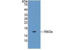 Western blot analysis of recombinant Rat FSHb. (FSHB anticorps  (AA 21-130))