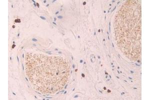Detection of PF4 in Human Stomach Tissue using Polyclonal Antibody to Platelet Factor 4 (PF4) (PF4 anticorps  (AA 31-101))
