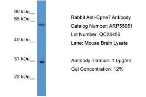 WB Suggested Anti-Cpne7  Antibody Titration: 0.