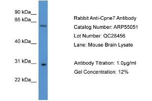 WB Suggested Anti-Cpne7  Antibody Titration: 0. (CPNE7 anticorps  (C-Term))
