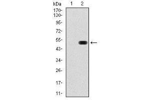 Image no. 2 for anti-Fibronectin 1 (FN1) antibody (ABIN1498273)