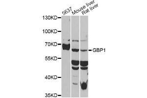 Western blot analysis of extracts of various cell lines, using GBP1 antibody (ABIN6293142) at 1:1000 dilution.