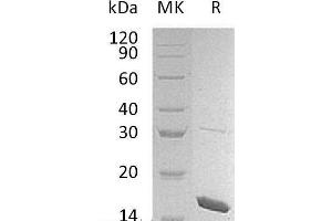 Western Blotting (WB) image for Interleukin 1 eta (FIL1h) protein (ABIN7320596) (FIL1h Protéine)