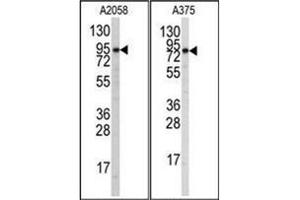 Western blot analysis of anti-Autophagy ATG9A Antibody (C-term) in A2058 and A375 cell line lysates (35ug/lane).