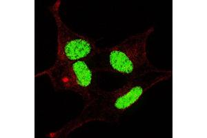 Fluorescent confocal image of SY5Y cells stained with phospho- LIN28-  antibody.
