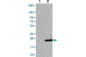 Western blot analysis of Lane 1: Negative control (vector only transfected HEK293T lysate). (CABP5 anticorps)