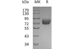 Western Blotting (WB) image for Interferon gamma Receptor 1 (IFNGR1) protein (Fc Tag) (ABIN7320564)