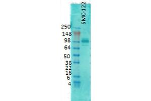 Western Blot analysis of Rat brain membrane lysate showing detection of PSD95 protein using Mouse Anti-PSD95 Monoclonal Antibody, Clone 6G6 . (DLG4 anticorps  (Atto 488))