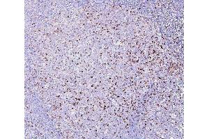 IHC analysis of RAB27A using anti-RAB27A antibody (ABIN7602714). (RAB27A anticorps  (AA 98-216))