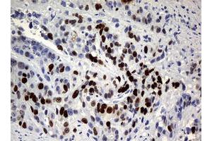 Image no. 3 for anti-Antigen Identified By Monoclonal Antibody Ki-67 (MKI67) (AA 1160-1493) antibody (ABIN1490857) (Ki-67 anticorps  (AA 1160-1493))