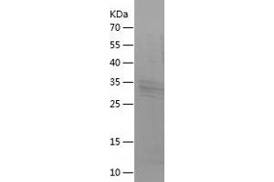 Brain Natriuretic Peptide (BNP) (AA 27-121) protein (His-IF2DI Tag)