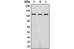 Western blot analysis of PSD93 expression in Jurkat (A), SHSY5Y (B), HepG2 (C) whole cell lysates. (DLG2 anticorps  (Center))