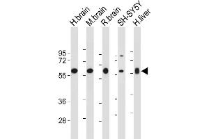 All lanes : Anti-INA Antibody (Center) at 1:2000 dilution Lane 1: Human brain tissue lysate Lane 2: Mouse brain tissue lysate Lane 3: Rat brain tissue lysate Lane 4: SH-SY5Y whole cell lysate Lane 5: Human liver tissue lysate Lysates/proteins at 20 μg per lane.