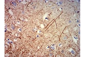 Immunohistochemical analysis of paraffin-embedded human cerebrum tissues using NEFH mouse mAb with DAB staining. (NEFH anticorps  (AA 2-251))