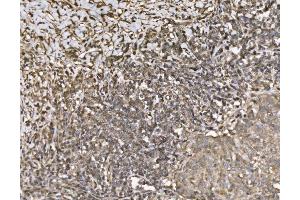 IHC analysis of KIF2A using anti-KIF2A antibody (ABIN7600510). (KIF2A anticorps  (AA 2-706))