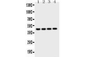 Observed bind size: 45KD (Cathepsin D anticorps  (AA 65-410))