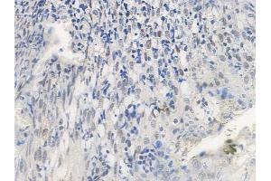 ABIN6255189 and ABIN6267704 at 1/100 staining human normal tonsil tissue by IHC-P.