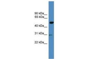 GAL3ST3 抗体  (AA 201-250)