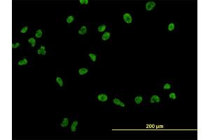 Immunofluorescence of monoclonal antibody to USF2 on HeLa cell. (USF2 anticorps  (AA 1-100))