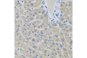 Immunohistochemistry of paraffin-embedded human liver using EIF2S3 antibody (ABIN5975415) at dilution of 1/100 (40x lens). (EIF2S3 anticorps)