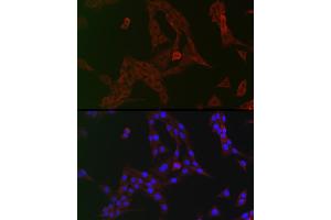 Immunofluorescence analysis of PC-12 cells using GCN2 Rabbit pAb (ABIN6127830, ABIN6140032, ABIN6140034 and ABIN6222976) at dilution of 1:150 (40x lens). (GCN2 anticorps  (AA 1-300))