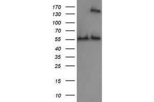 HEK293T cells were transfected with the pCMV6-ENTRY control (Left lane) or pCMV6-ENTRY CAT (Right lane) cDNA for 48 hrs and lysed. (Catalase anticorps)