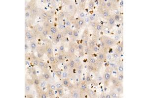 Immunohistochemistry of paraffin-embedded Human liver using IGF1 antibody (ABIN1682184, ABIN3015345, ABIN3015346 and ABIN7101347) at dilution of 1:100 (40x lens). (IGF1 anticorps)