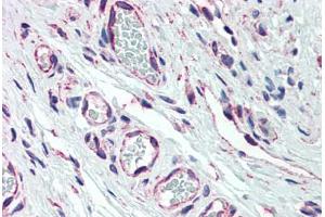 anti-Phosphoinositide-3-Kinase, Class 2, alpha Polypeptide (PIK3C2A) (AA 1577-1687) antibody