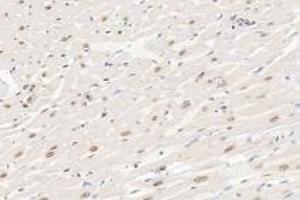 Immunohistochemistry analysis of paraffin-embedded rat heart using,Ring1A (ABIN7075467) at dilution of 1: 3600