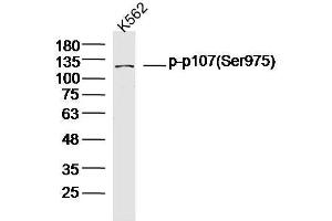 Human K562 cells probed with p107(Ser975) Polyclonal Antibody, unconjugated  at 1:300 overnight at 4°C followed by a conjugated secondary antibody at 1:10000 for 90 minutes at 37°C.