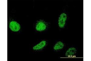 Image no. 2 for anti-Cold Shock Domain Containing C2, RNA Binding (CSDC2) (AA 1-154) antibody (ABIN466198) (CSDC2 anticorps  (AA 1-154))