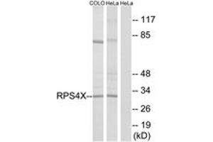 Western blot analysis of extracts from HeLa/COLO cells, using RPS4X Antibody. (RPS4X anticorps  (AA 81-130))
