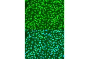 Immunofluorescence analysis of U2OS cells using BDNF antibody (ABIN1871274) at dilution of 1:100. (BDNF anticorps)