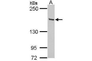 WB Image Sample (30 ug of whole cell lysate) A: Jurkat 5% SDS PAGE antibody diluted at 1:1000