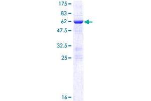 Image no. 1 for Nitric Oxide Synthase Interacting Protein (NOSIP) (AA 1-301) protein (GST tag) (ABIN1312806)