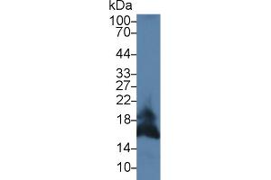 Detection of FASL in Mouse Pancreas lysate using Polyclonal Antibody to Factor Related Apoptosis Ligand (FASL) (FASL anticorps  (AA 132-279))