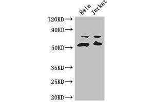 Western Blot Positive WB detected in: Hela whole cell lysate, Jurkat whole cell lysate All lanes: YES1 antibody at 3. (YES1 anticorps  (AA 1-155))