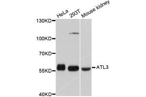 Western blot analysis of extracts of various cell lines, using ATL3 antibody (ABIN5997276) at 1/1000 dilution. (ATL3 anticorps)