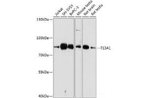 Western blot analysis of extracts of various cell lines using F13A1 Polyclonal Antibody at dilution of 1:3000. (F13A1 anticorps)