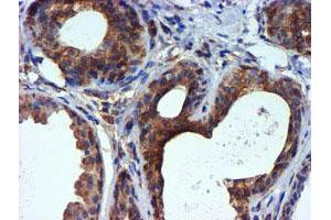 Immunohistochemical staining of paraffin-embedded Human breast tissue using anti-TUBAL3 mouse monoclonal antibody. (TUBAL3 anticorps  (AA 150-446))
