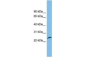WB Suggested Anti-GSTK1 Antibody Titration: 0. (GSTK1 anticorps  (Middle Region))