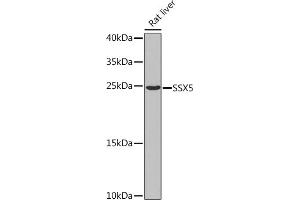 Western blot analysis of extracts of Rat liver, using SSX5 Rabbit pAb  at 1:1000 dilution. (SSX5 anticorps  (AA 1-229))