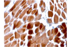 Formalin-fixed, paraffin-embedded human Cardiac Muscle stained with Sarcomeric Actinin Alpha 2 Mouse Monoclonal Antibody (ACTN2/3292).